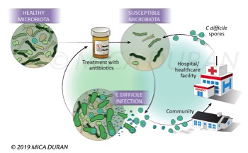  C Difficile Infection Cycle 