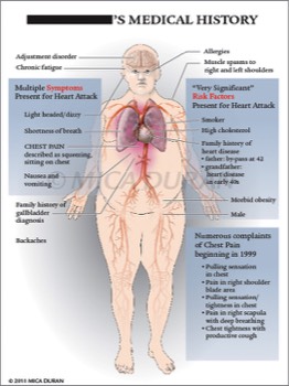  Heart Attack Symptoms, Risk Factors and History 