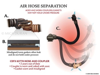  Transportation Injury - Whipping Air Hose 