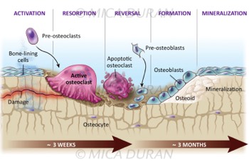  Bone Remodeling Stages 